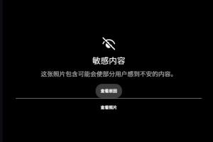惊悚！慎看！范德彪小拇指骨头暴露无遗！