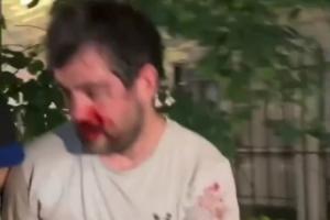 “邓肯”惨被纽约暴徒围攻，被打至退出刺籍，鲜血淋漓脱衣保命